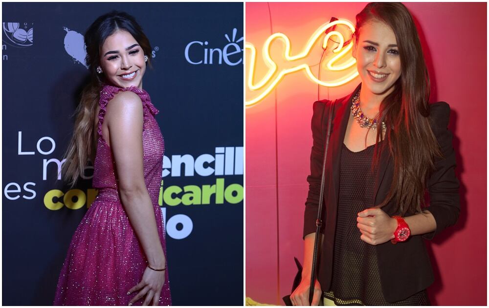 Famosos que cambiaron por completo sus rostros con cirugías o bótox