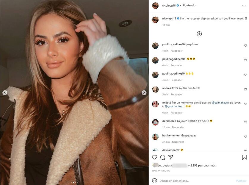 ¿Qué se hizo Nicole Peña en la cara? Su impactante transformación ¡luce guapísima!