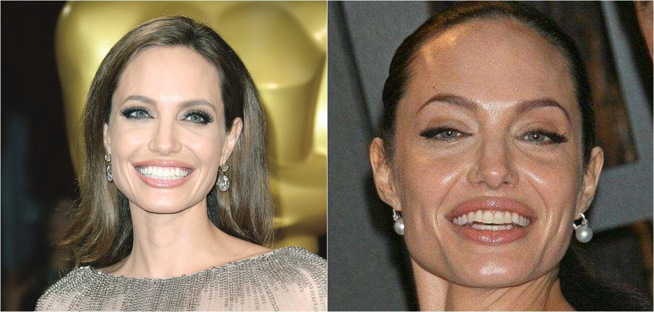 Las peores fotos de las celebridades