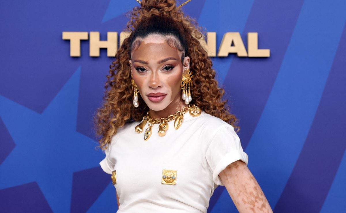Winnie Harlow. (Foto: AFP)
