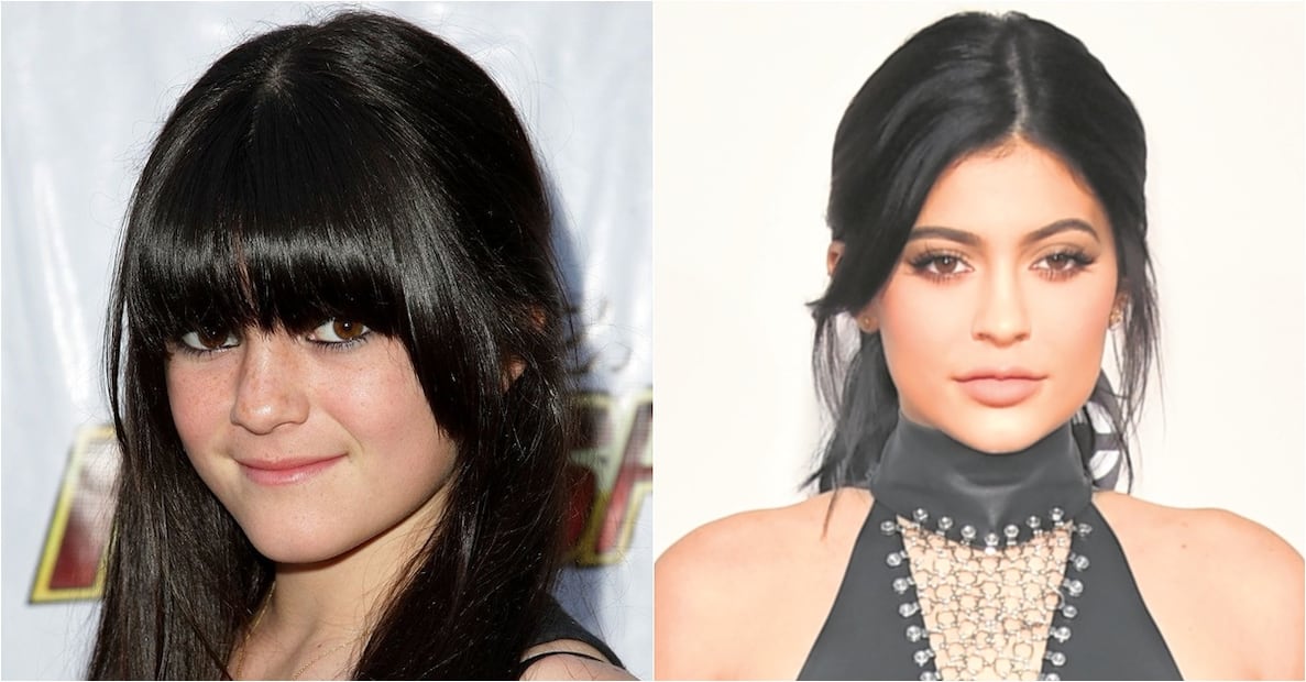Las Kardashian antes y después del quirófano
