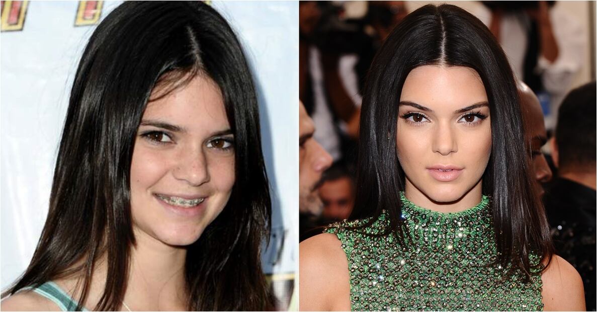 Las Kardashian antes y después del quirófano