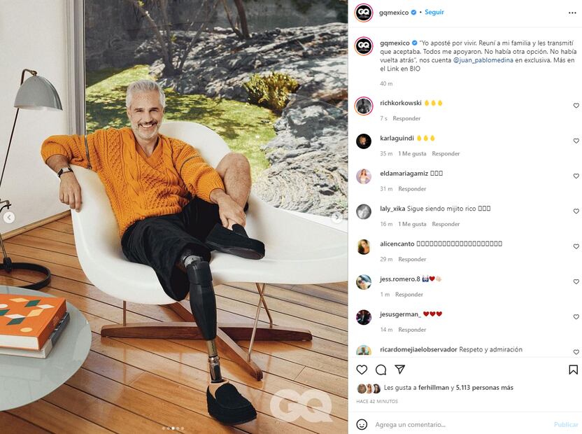 Juan Pablo Medina habla de su estado de salud y posa tras la amputación de una pierna