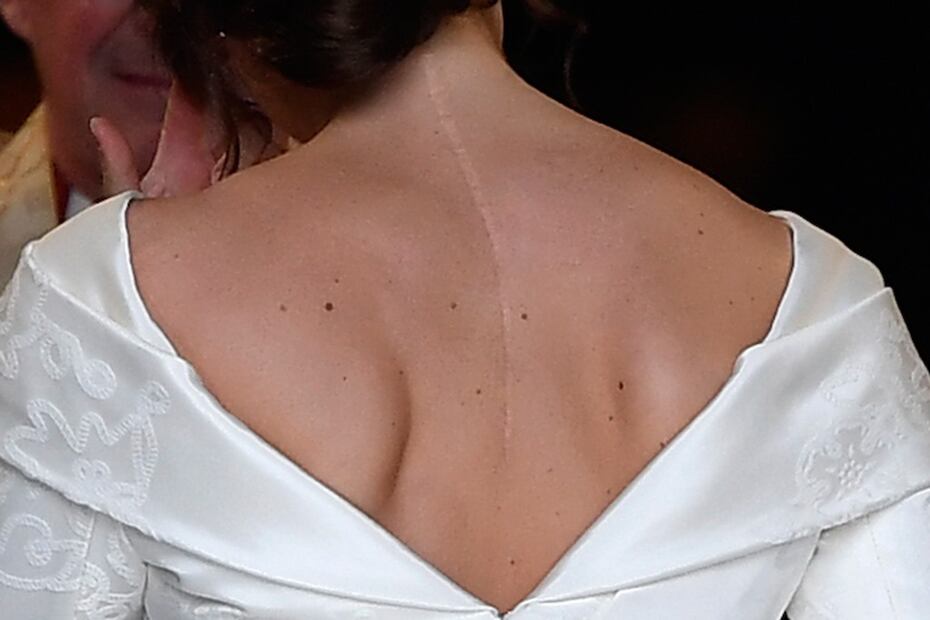 La cicatriz en la espalda de la princesa Eugenia y otros detalles en la boda real