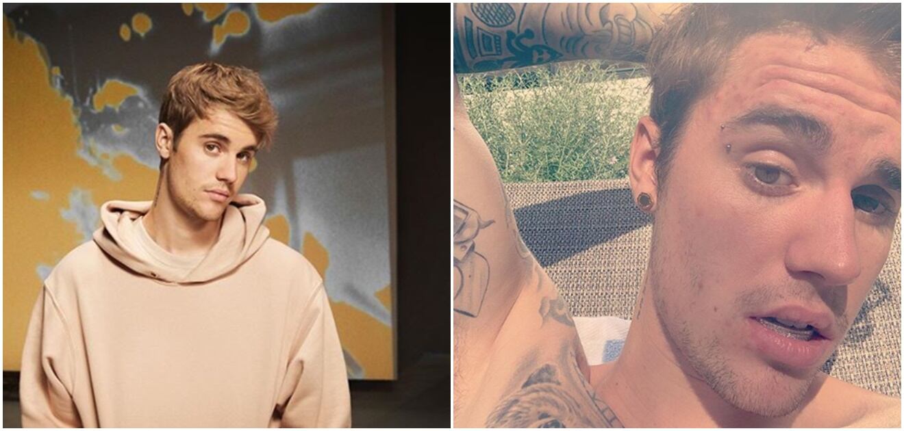 Justin Bieber y su extravagante dentadura de diamantes color púrpura