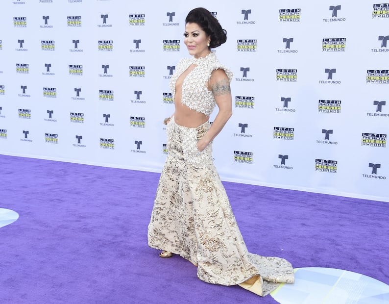 'Soy de titanio': Alejandra Guzmán compartió una radiografía de su prótesis 