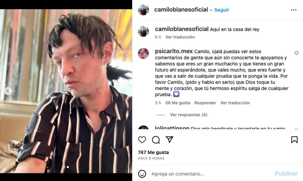 Camilín, hijo de Camilo Sesto, reaparece y enciende las alarmas por su aspecto
