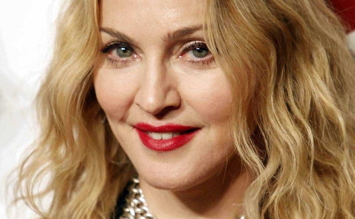 Madonna impacta con la cara 'desfigurada' y bromea con sus fans