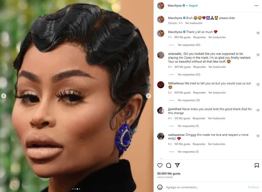 Blac Chyna muestra su nueva cara en un antes y después tras retirarse los fillers