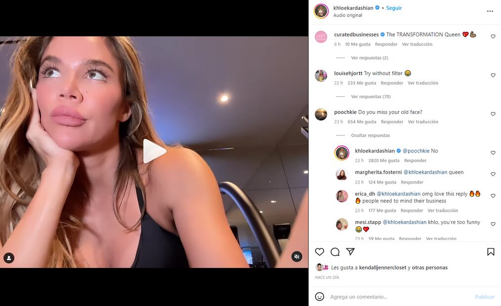 Khloé Kardashian responde a las críticas, "¿Extrañas tu antigua cara?"