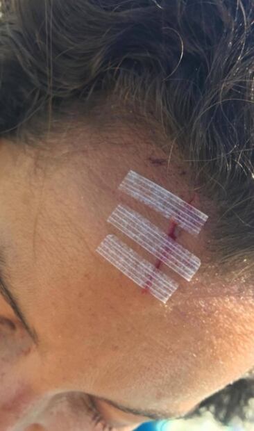 FOTOS: Así quedó Sara Maldonado tras sufrir accidente 