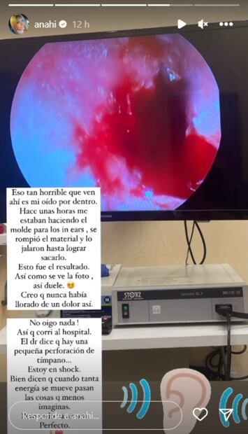 Anahí compartió la dolorosa noticia con sus seguidores en Instagram