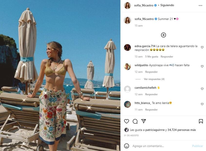 Sofía Castro revela que volverá a usar brackets de metal