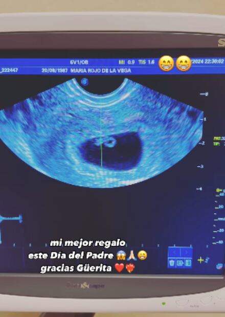 Alexander Acha y María Rojo de la Vega esperan a su tercer bebé / Foto: Instagram