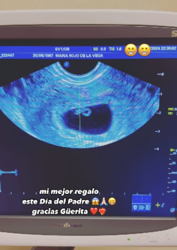 Alexander Acha y María Rojo de la Vega esperan a su tercer bebé / Foto: Instagram