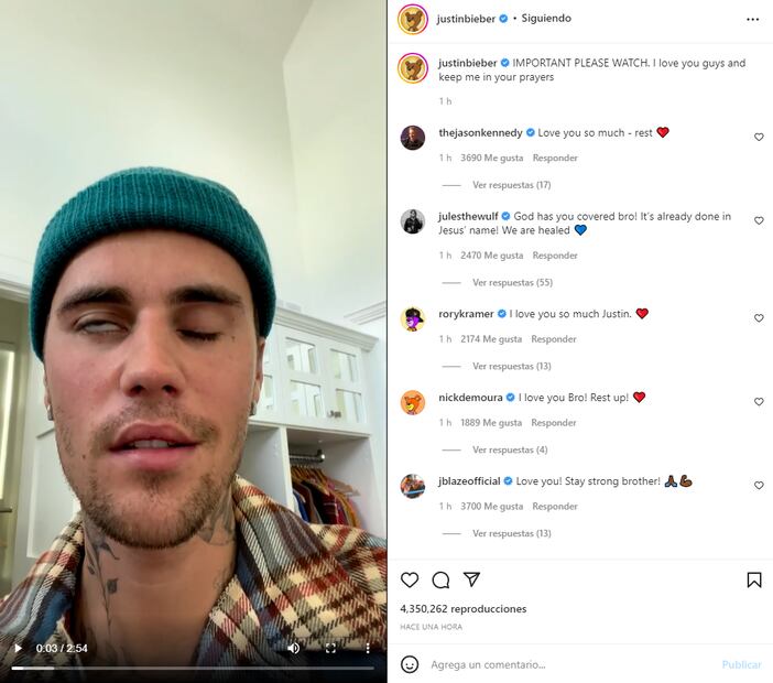 Justin Bieber muestra su cara tras sufrir parálisis por síndrome Ramsay Hunt