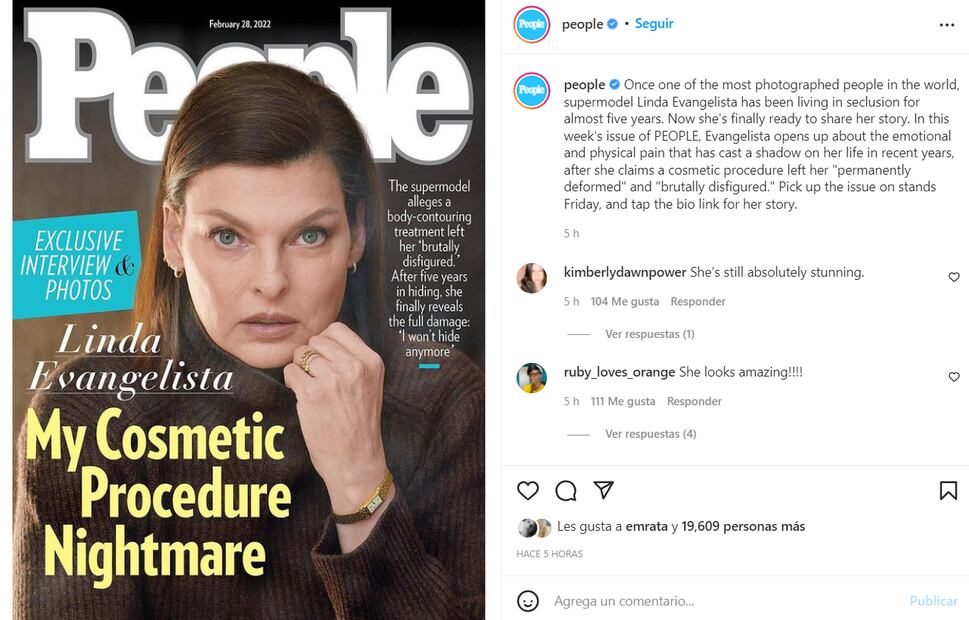 Linda Evangelista se muestra, por primera vez, tras revelar que quedó "brutalmente desfigurada" por tratamiento estético