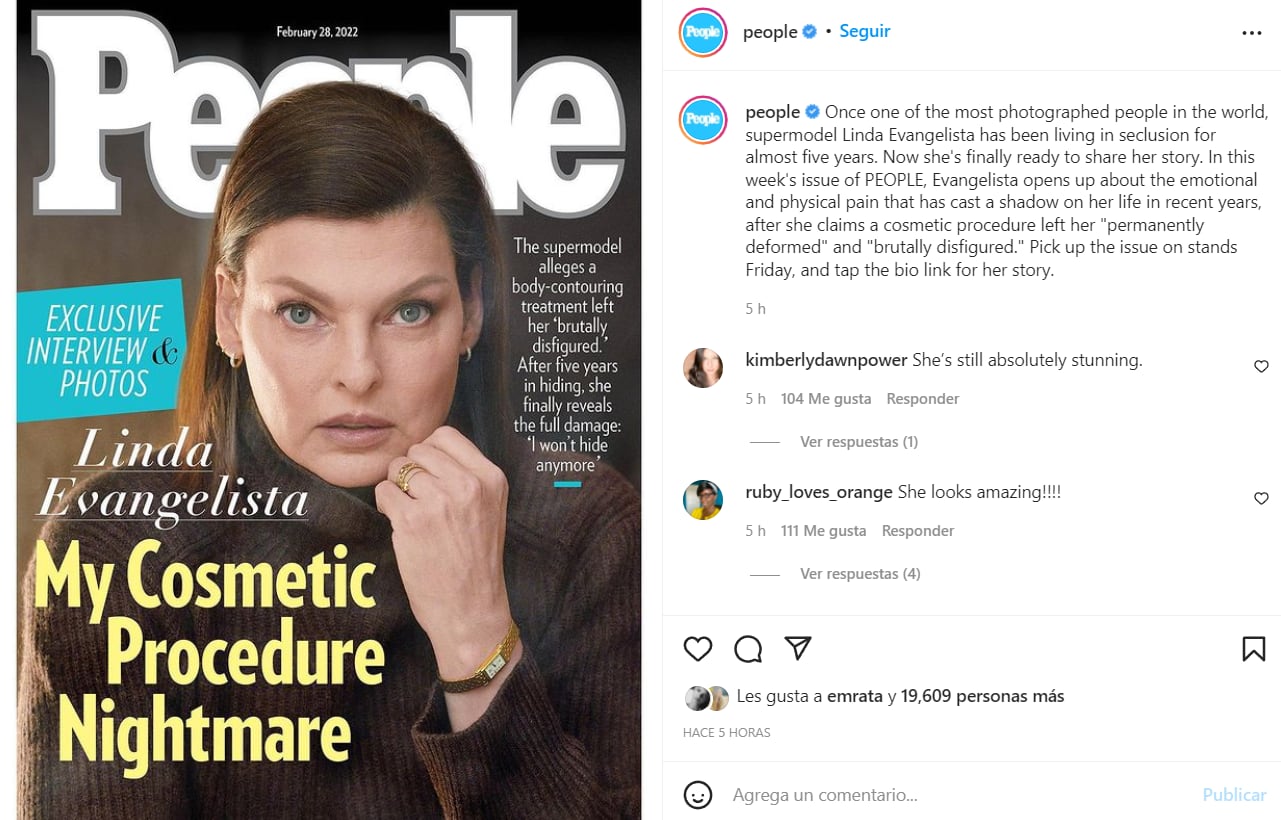 Linda Evangelista se muestra, por primera vez, tras revelar que quedó "brutalmente desfigurada" por tratamiento estético