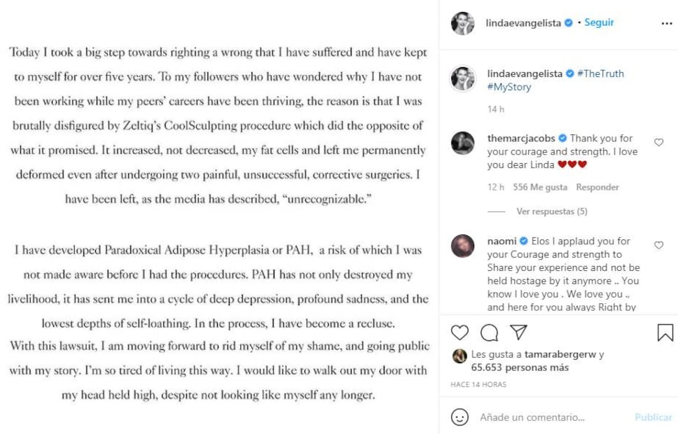 Linda Evangelista, "brutalmente desfigurada" tras someterse a un tratamiento estético