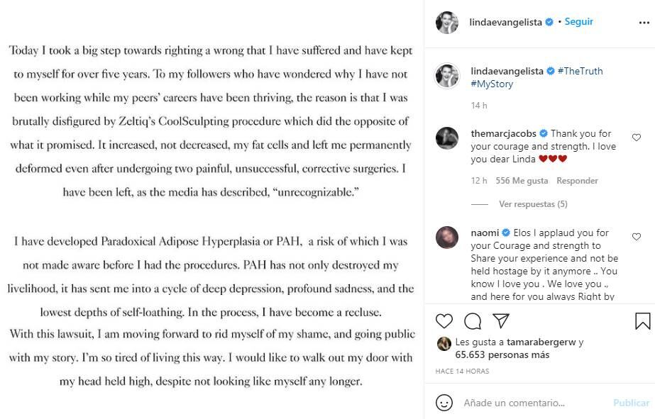 Linda Evangelista, "brutalmente desfigurada" tras someterse a un tratamiento estético