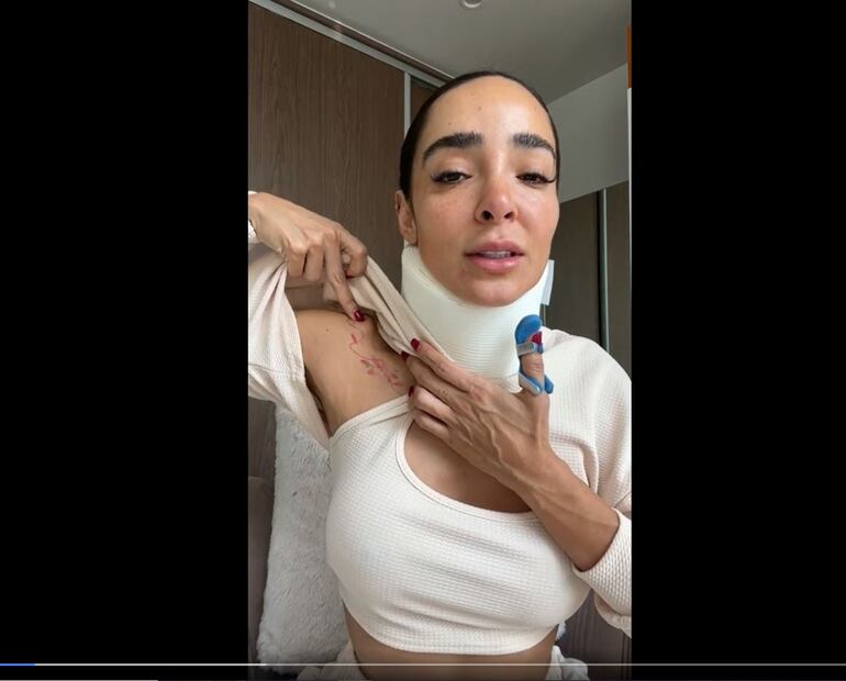 Manelyk González podría no volver a “Las Estrellas bailan en Hoy” por fuertes daños
