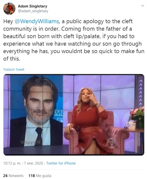 La presentadora de televisión Wendy Williams se burló de la cicatriz en el labio de Joaquin Phoenix 
