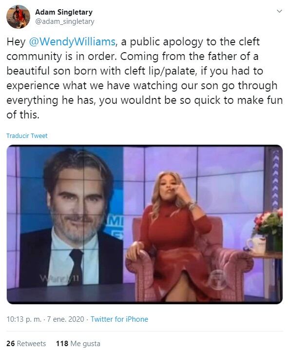 La presentadora de televisión Wendy Williams se burló de la cicatriz en el labio de Joaquin Phoenix 