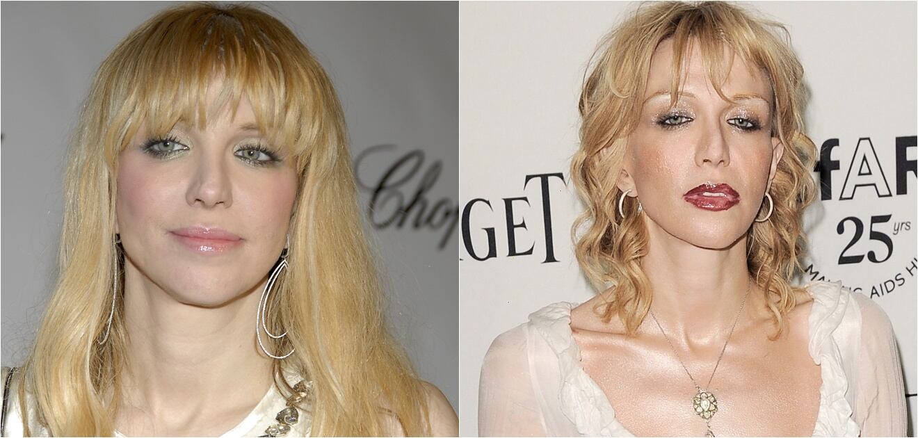 Famosos que envejecieron mal