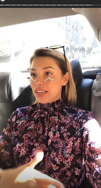 Sorprende Michelle Salas con nuevos labios