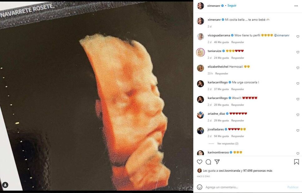 Ximena Navarrete presume la carita de su bebé