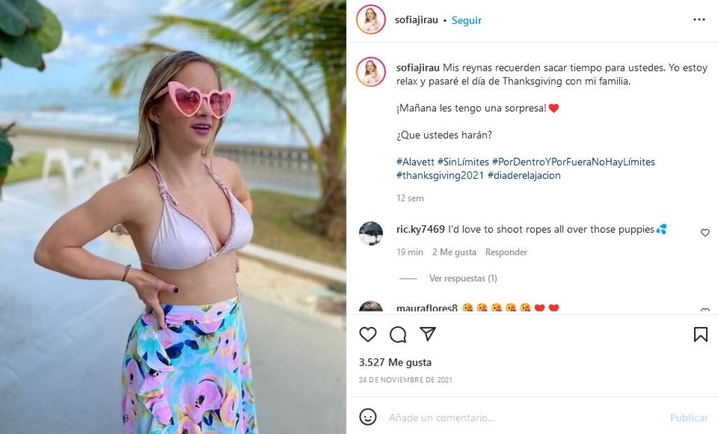 5 cosas que debes saber de Sofia Jirau, la modelo con Síndrome de Down de Victoria’s Secret
