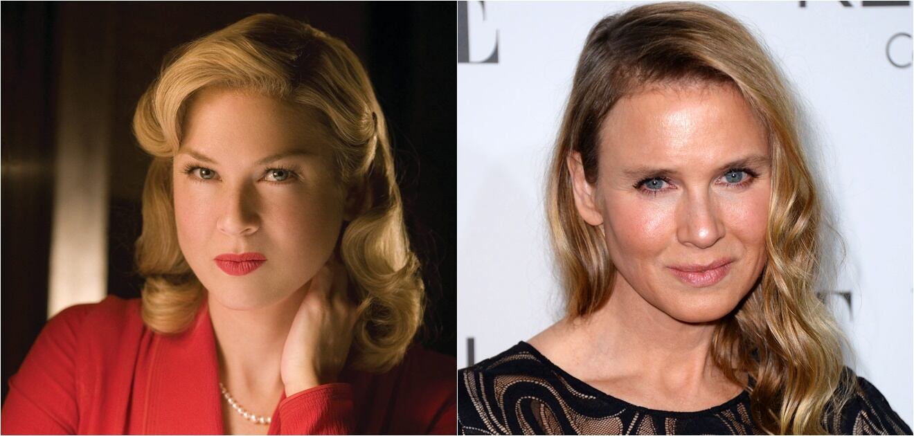 Famosos que cambiaron por completo sus rostros con cirugías o bótox