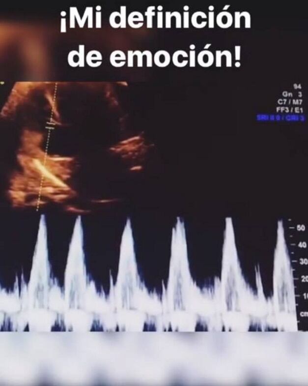 Nace el hijo de Alfredo del Mazo Maza y Fernanda Castillo