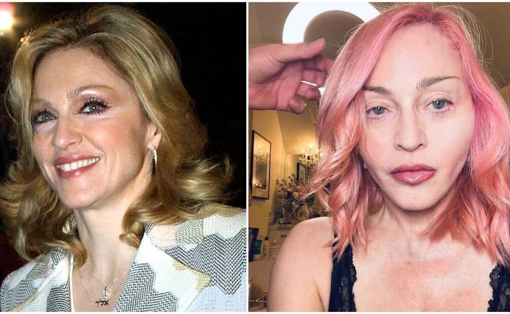 Madonna, de 62 años, impacta sin arrugas 