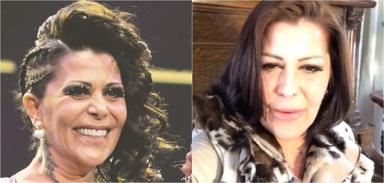 Famosos que cambiaron por completo sus rostros con cirugías o bótox