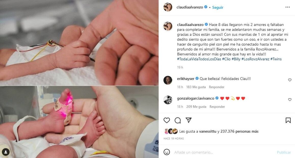 Los bebés de Claudia Álvarez y Billy Rovzar nacen prematuramente