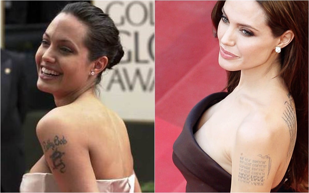 Famosos que se borraron los tatuajes de sus ex