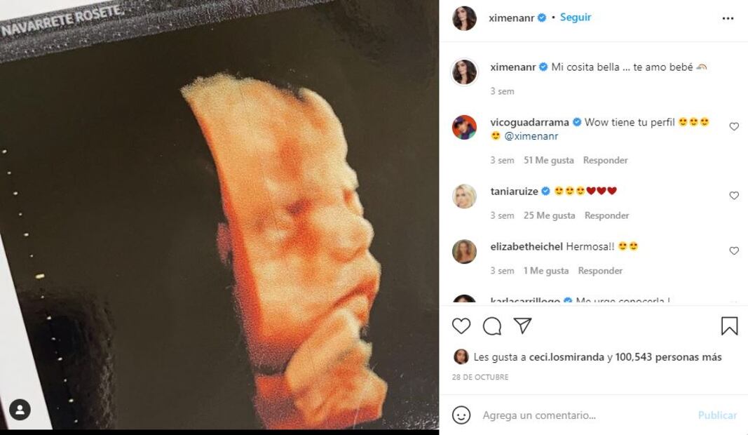 Ximena Navarrete comparte el largo camino de su embarazo