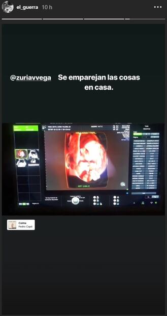 Zuria Vega y Alberto Guerra revelan nombre de su bebé, ¿será niño o niña?
