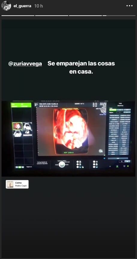 Zuria Vega y Alberto Guerra revelan nombre de su bebé, ¿será niño o niña?