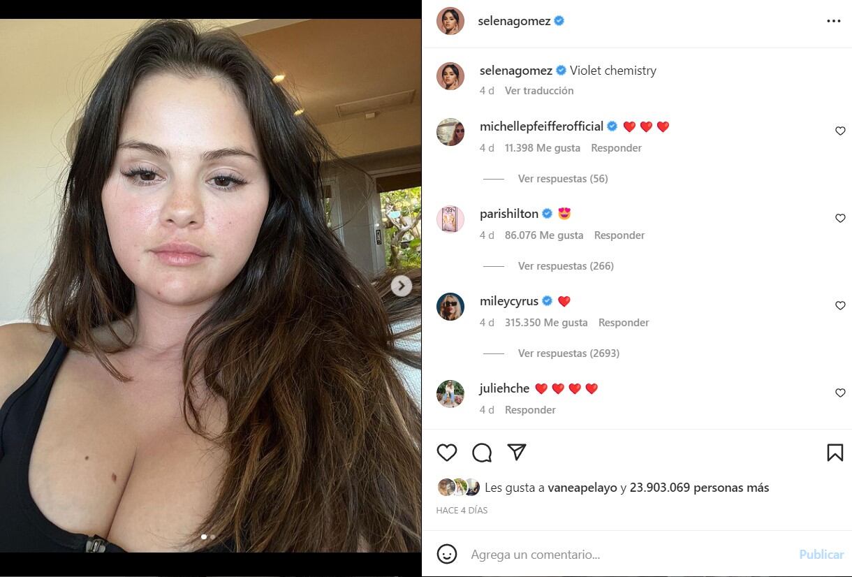 Selena Gomez destrona a Kylie Jenner con 400 millones de seguidores en Instagram con una foto al natural