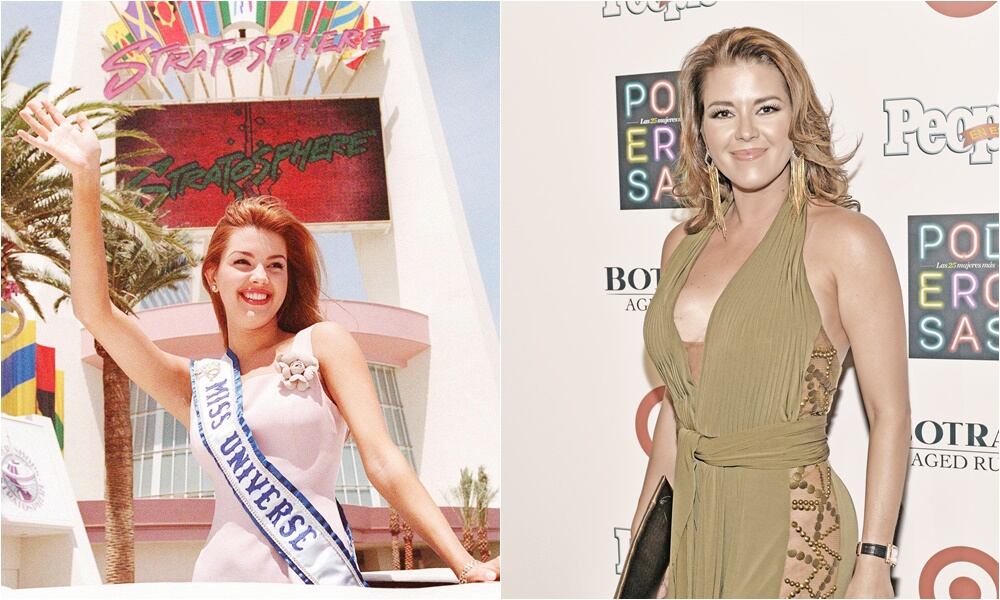 Las cirugías de las reinas de belleza