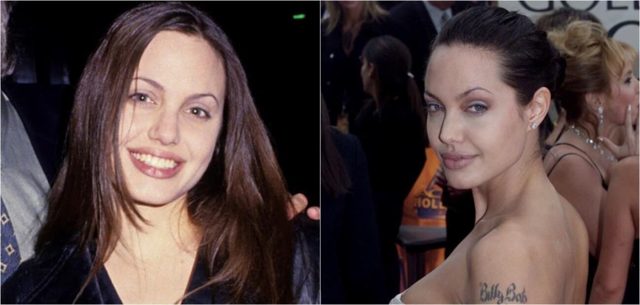 FOTOS: 5 famosas con labios sensuales gracias al bótox