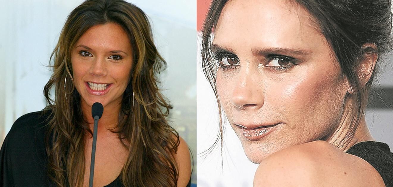 <p>Victoria Beckham ha cambiado drásticamente de figura, la cara se le ve mucho más delgada que en sus inicios en la música. <strong>(Fotos: Archivo El Universal)</strong></p>
