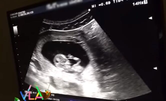 Tania Rincón anuncia su primer embarazo