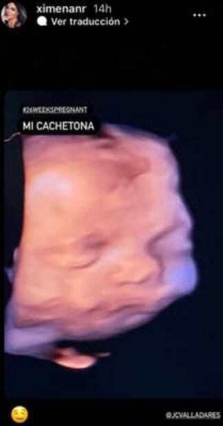 Ximena Navarrete presume la carita de su bebé