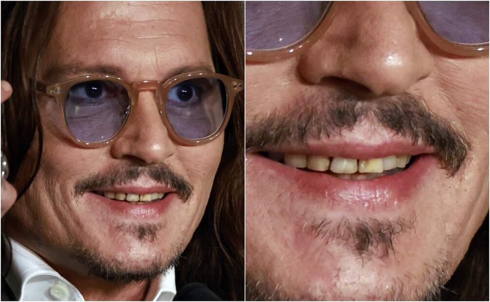 Johnny Depp es criticado por su estado dental