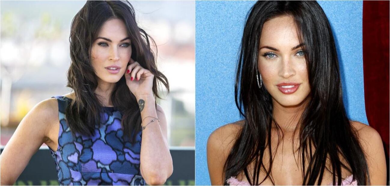 FOTOS: 5 famosas con labios sensuales gracias al bótox