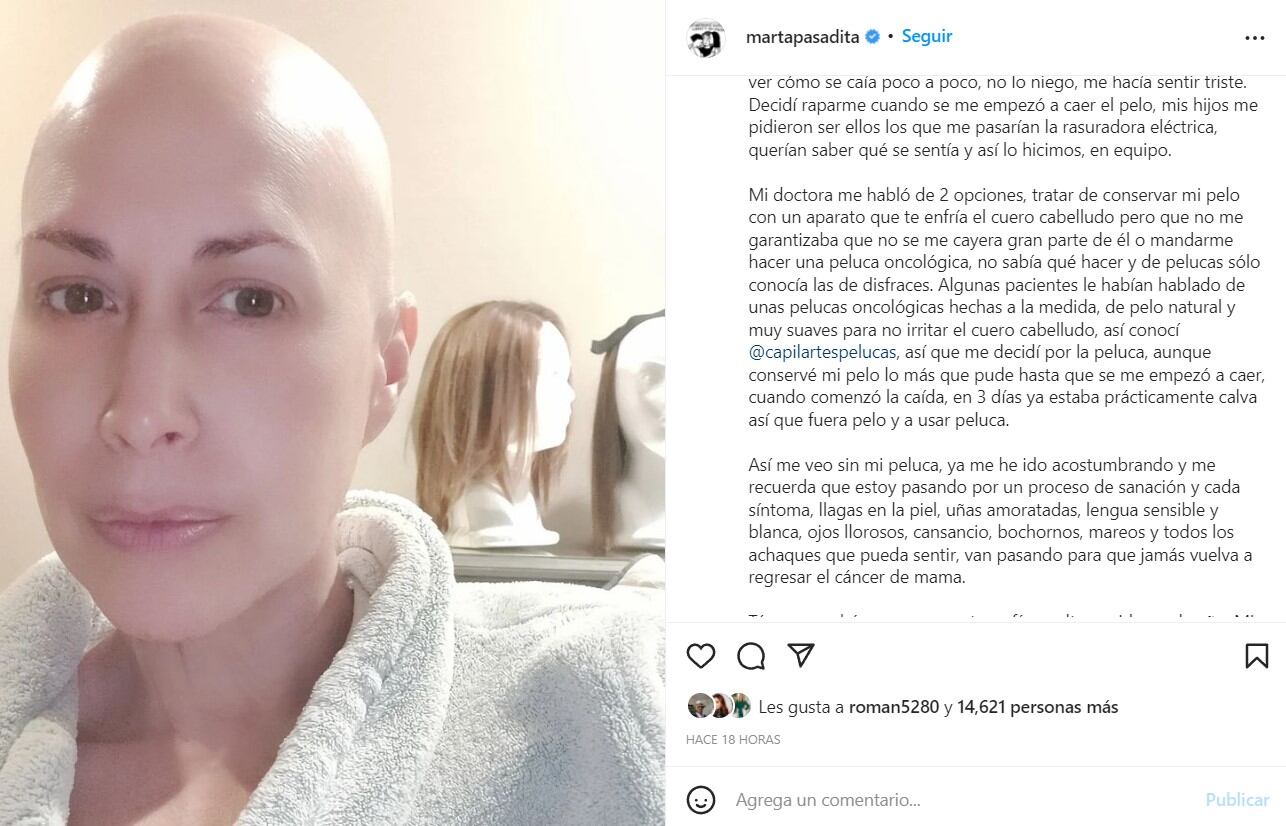 Marta Guzmán, sin pelo, comparte primera foto en su lucha contra el cáncer