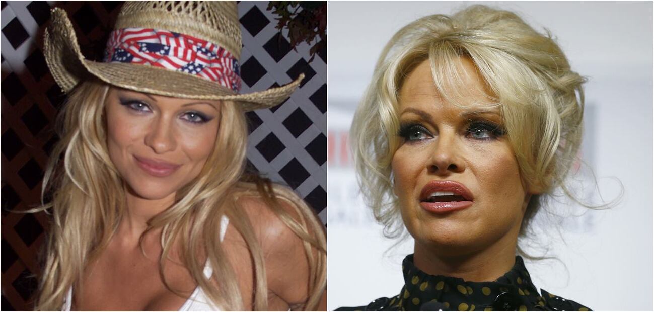 Las actrices de los 90 que se cambiaron el rostro 